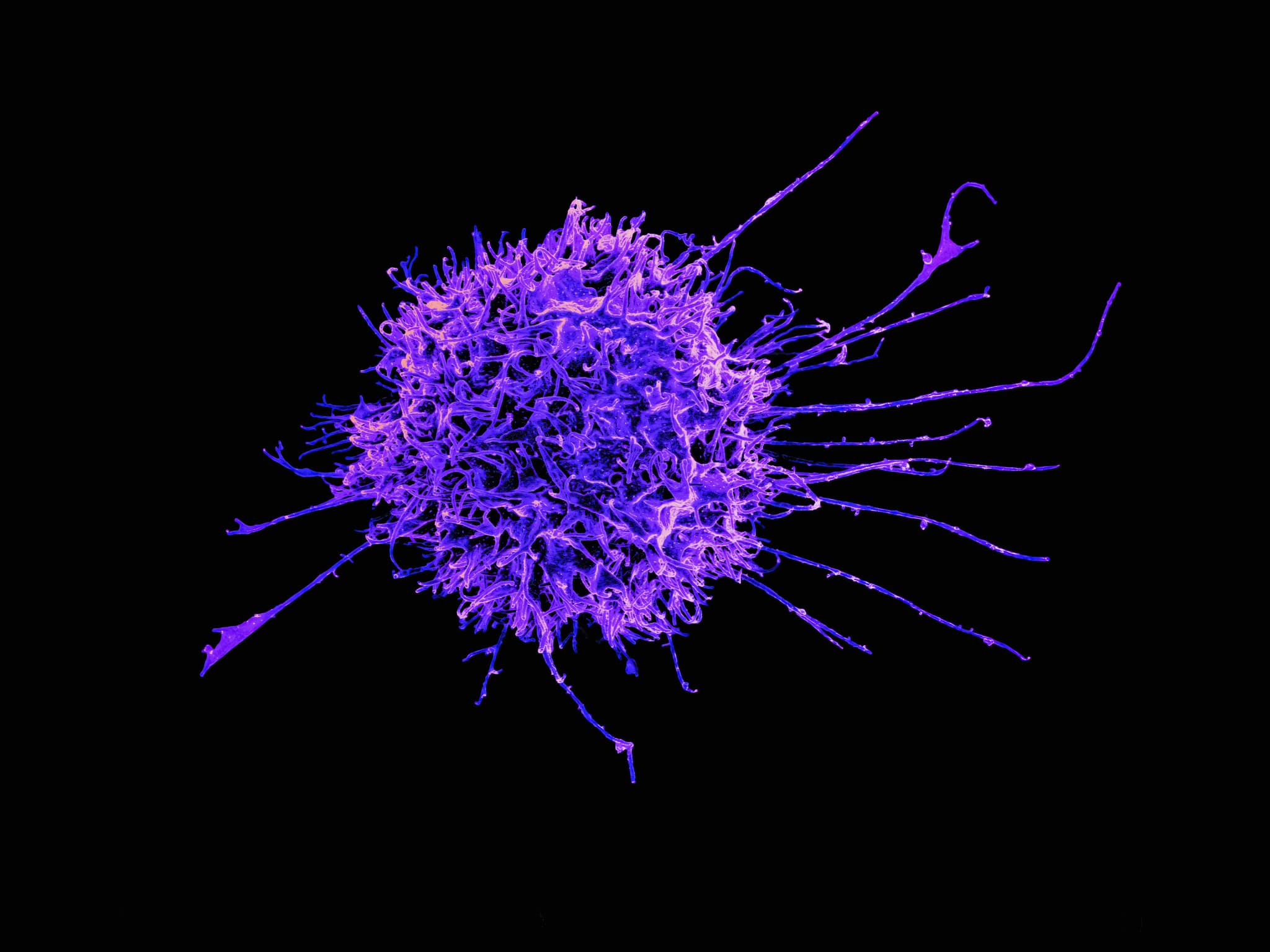 lymphocytes