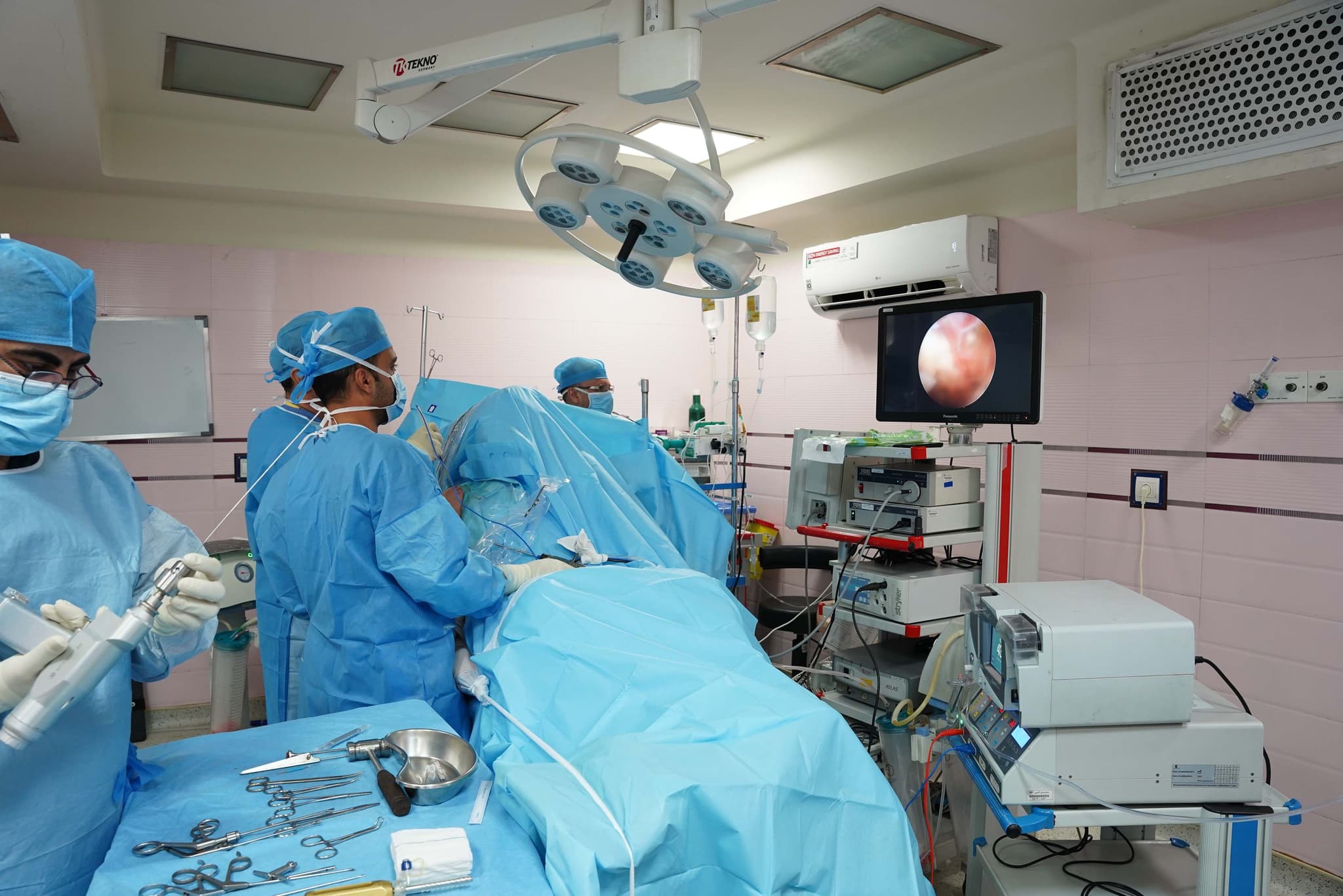 vulvar cancer