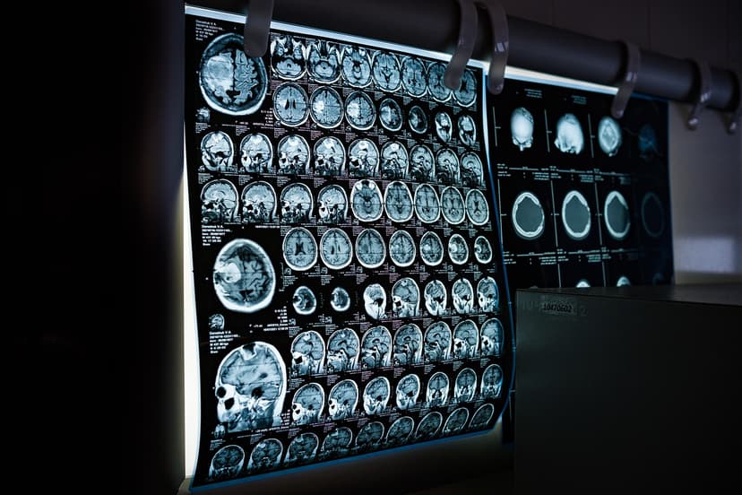 X-ray