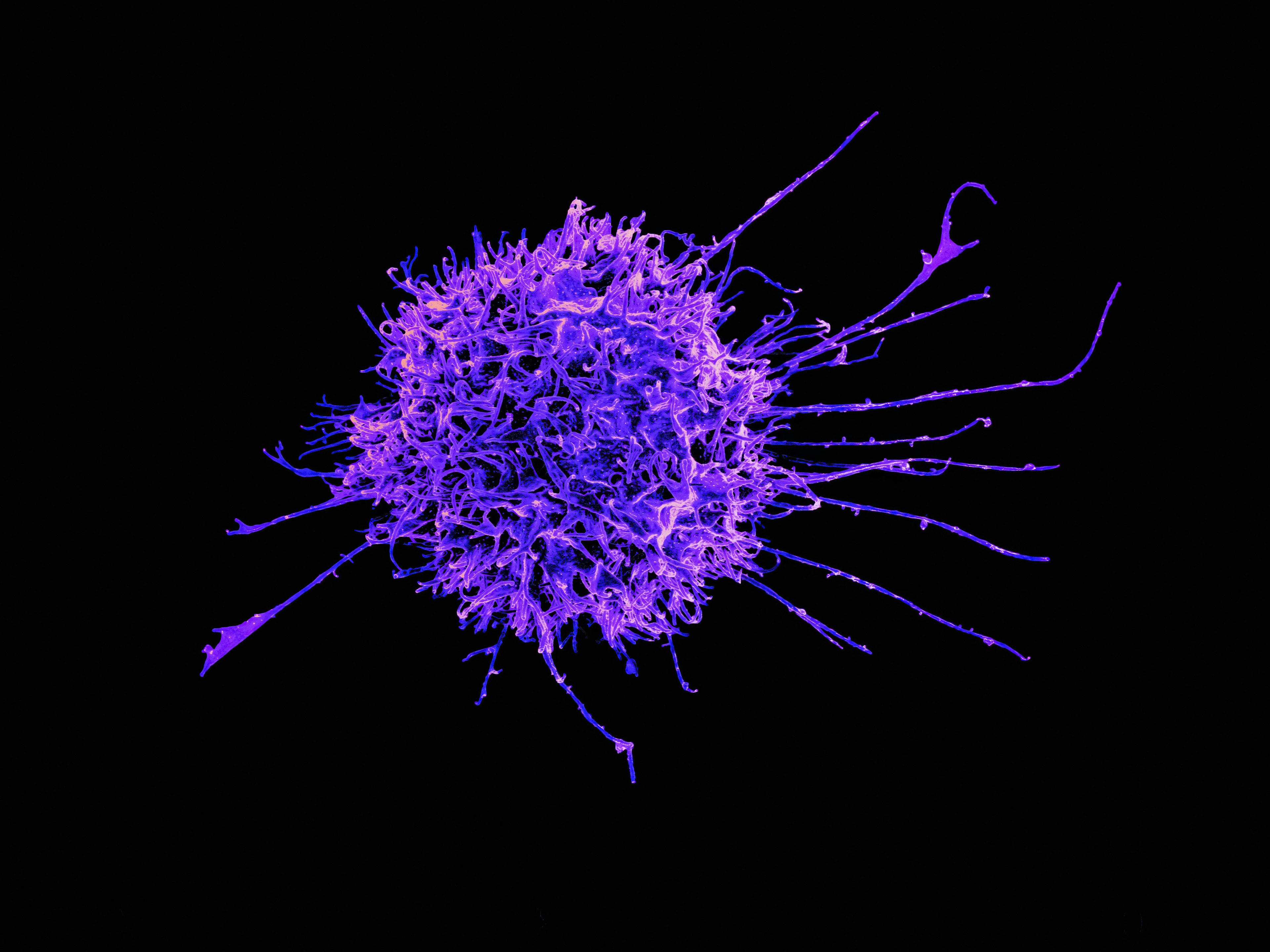lymphocytes